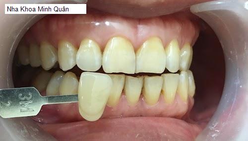Hình ảnh Nha Khoa Minh Quân