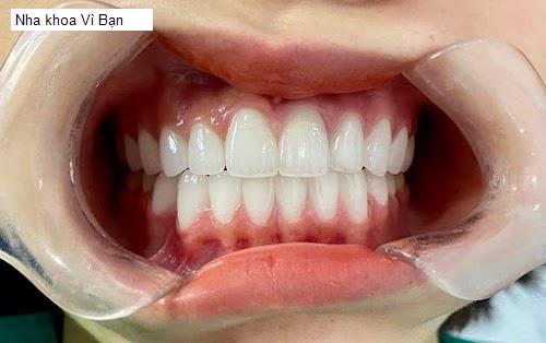 Hình ảnh Nha khoa Vì Bạn