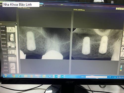 Hình ảnh Nha Khoa Bảo Linh