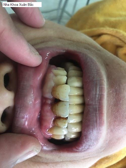 Hình ảnh Nha Khoa Xuân Bắc