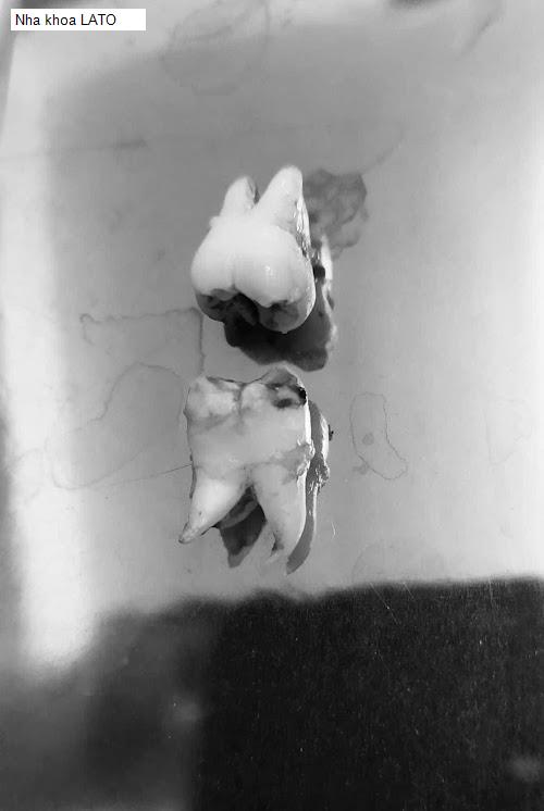 Hình ảnh Nha khoa LATO