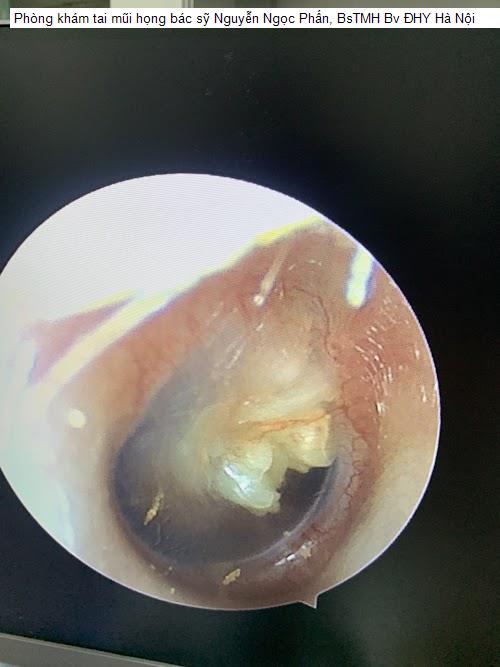 Hình ảnh Phòng khám tai mũi họng bác sỹ Nguyễn Ngọc Phấn, BsTMH Bv ĐHY Hà Nội
